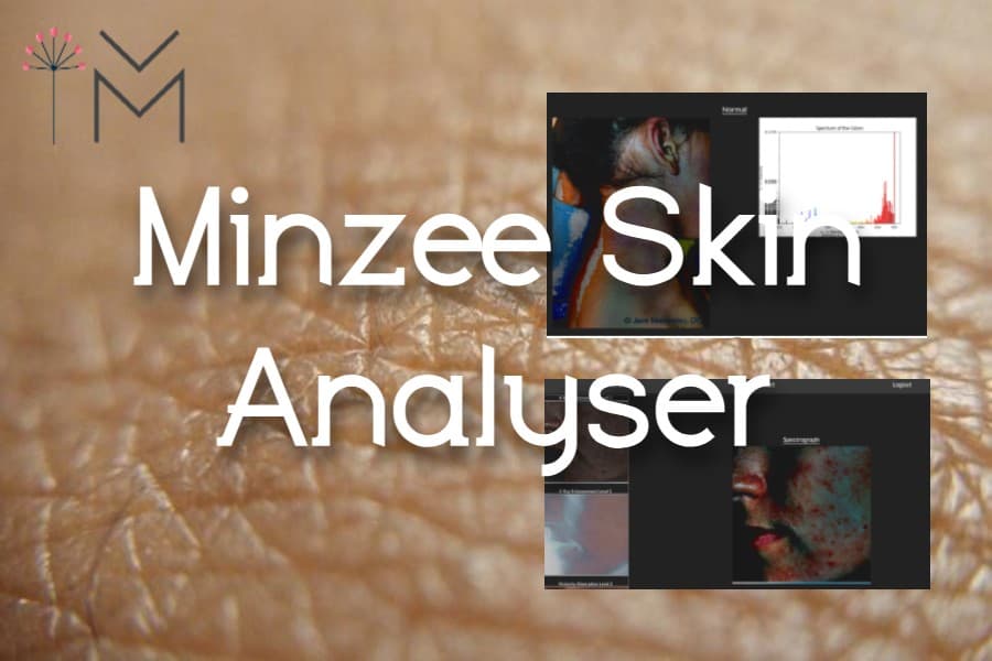 Minzee Skin Analyser